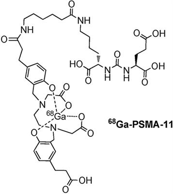 Advancements in PSMA ligand radiolabeling for diagnosis and treatment of prostate cancer: a systematic review